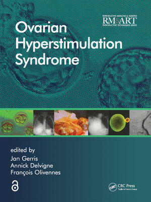 cover image of Ovarian Hyperstimulation Syndrome